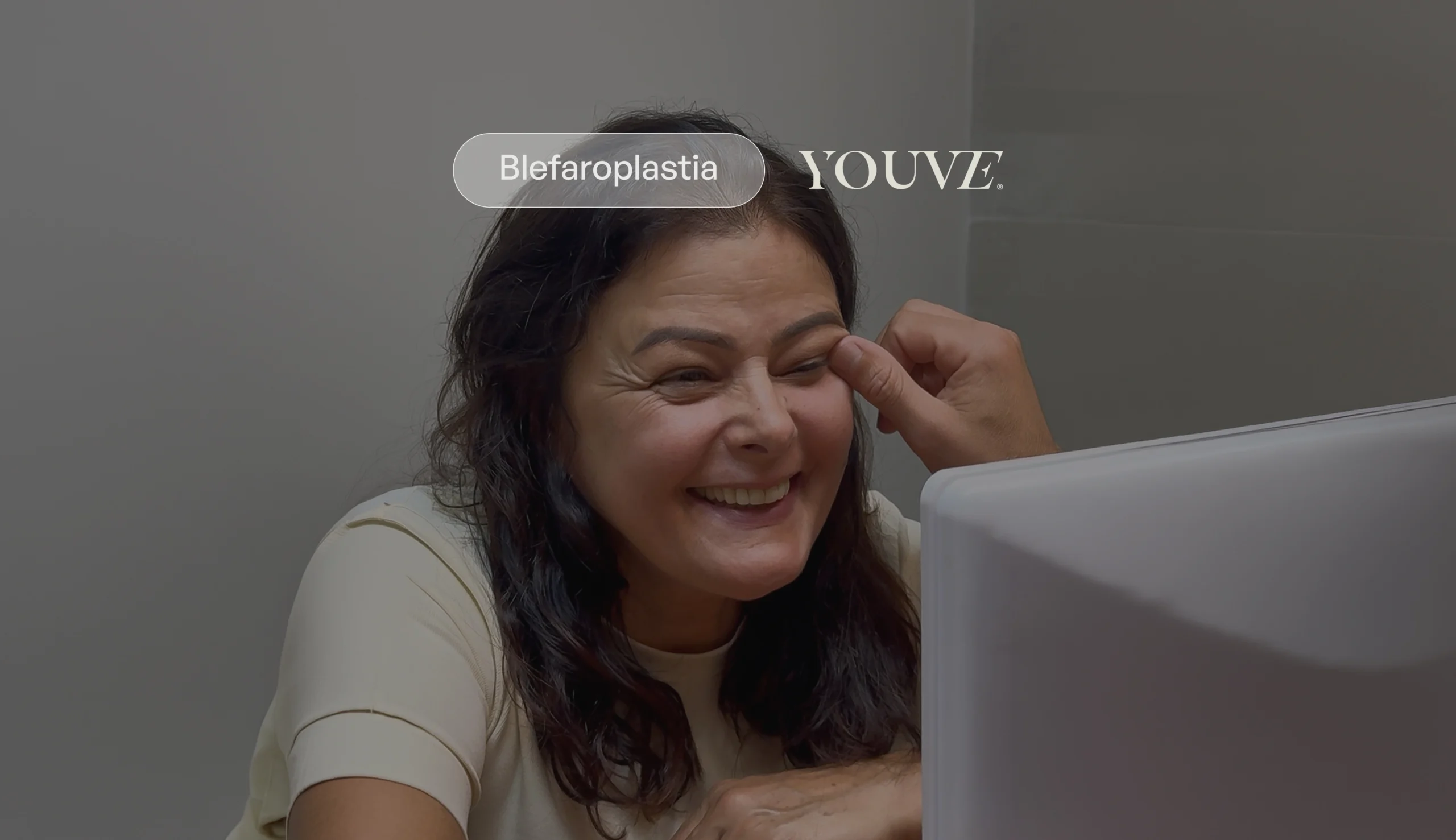 Blefaroplastia superior: quando é indicada e como ela muda o seu olhar