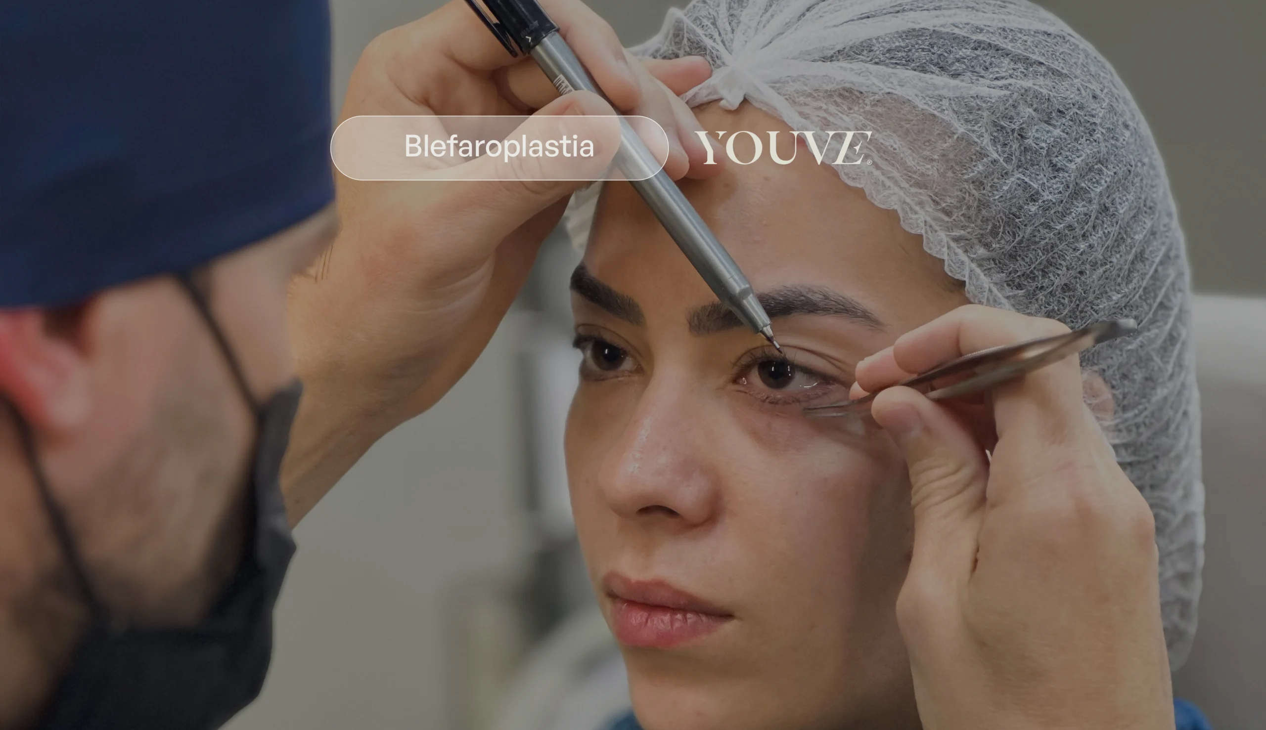 Baby bleph: a tendência que valoriza seu olhar jovem