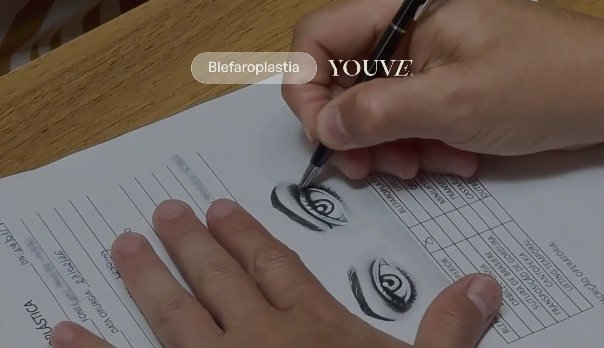 CID da blefaroplastia: quando a cirurgia das pálpebras é considerada funcional
